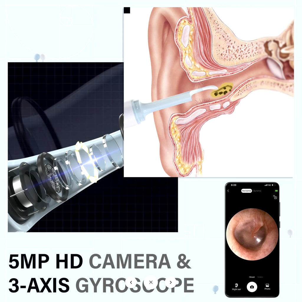Ear Wax Removal Pick Led Wireless Ear Camera Otoscope Visual Kit Exempt Smart