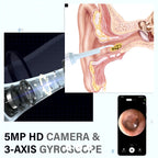 Ear Wax Removal Pick Led Wireless Ear Camera Otoscope Visual Kit Exempt Smart